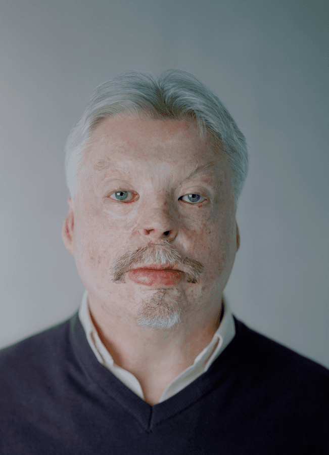 Simon Weston CBE sustained burns as a result of enemy action in the Falklands War.